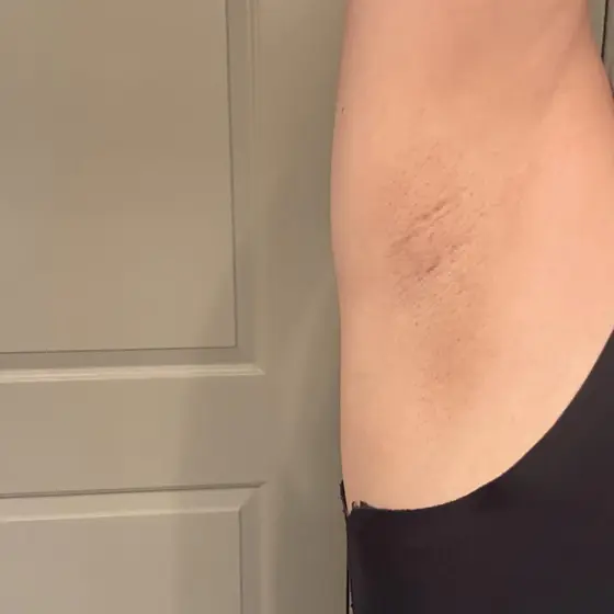 Customer photo