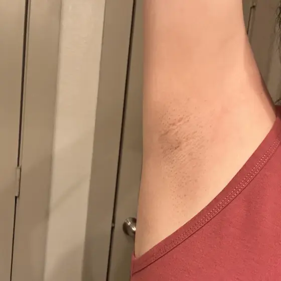 Customer photo