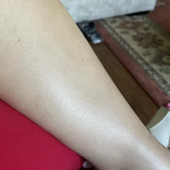 Customer photo