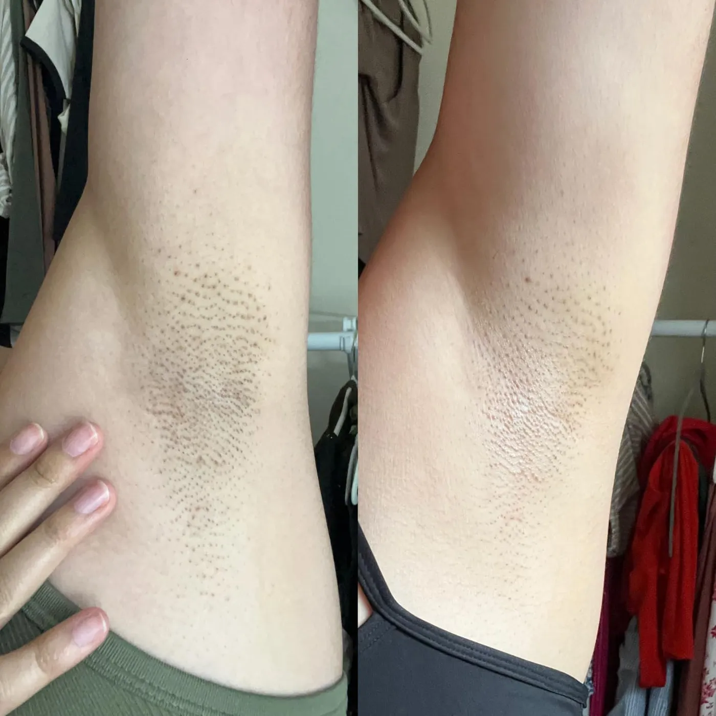 Customer before and after comparison