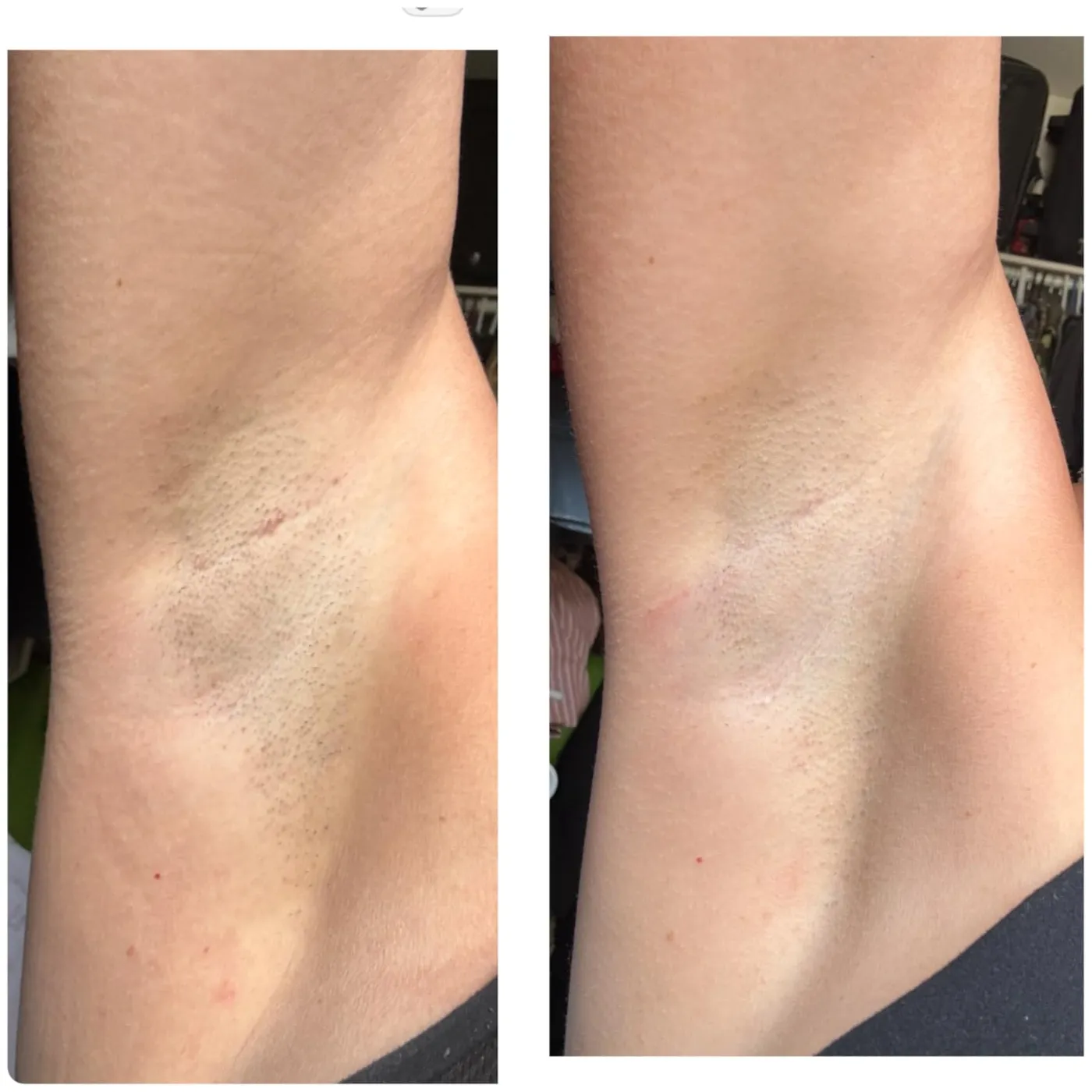 Customer before and after comparison