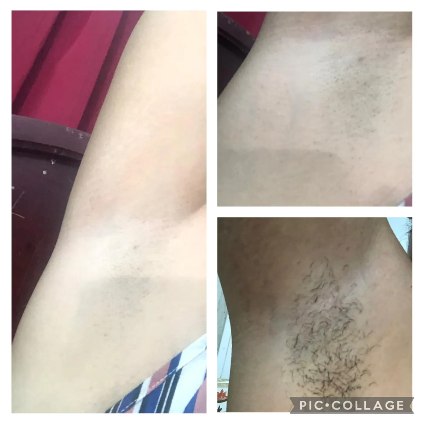 Customer before and after comparison