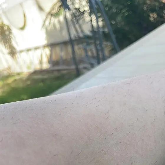 Customer photo
