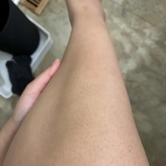 Customer photo